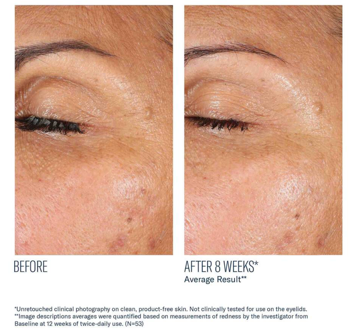 EyeMax AlphaRet Overnight Cream