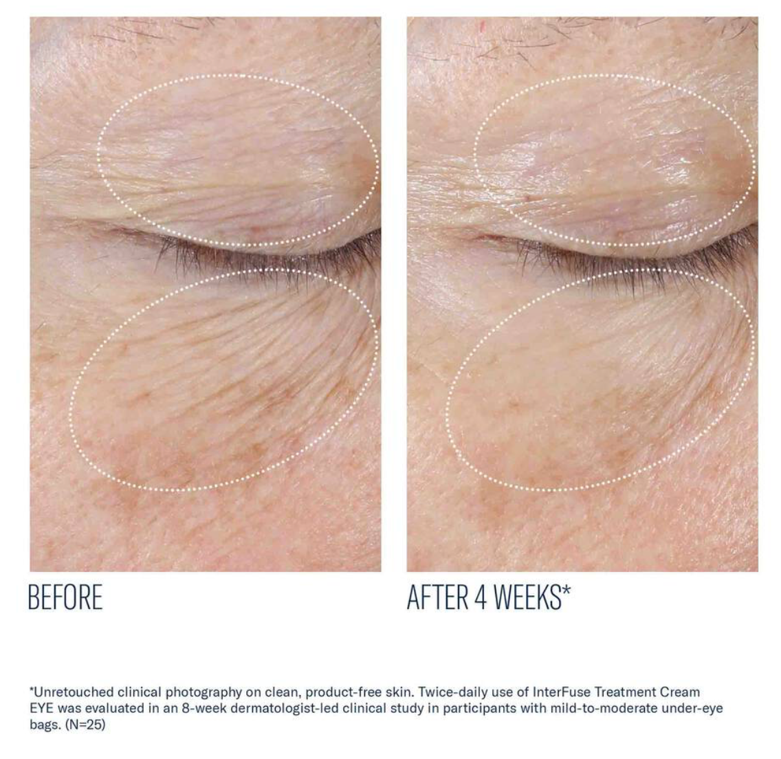 InterFuse Treatment Cream EYE