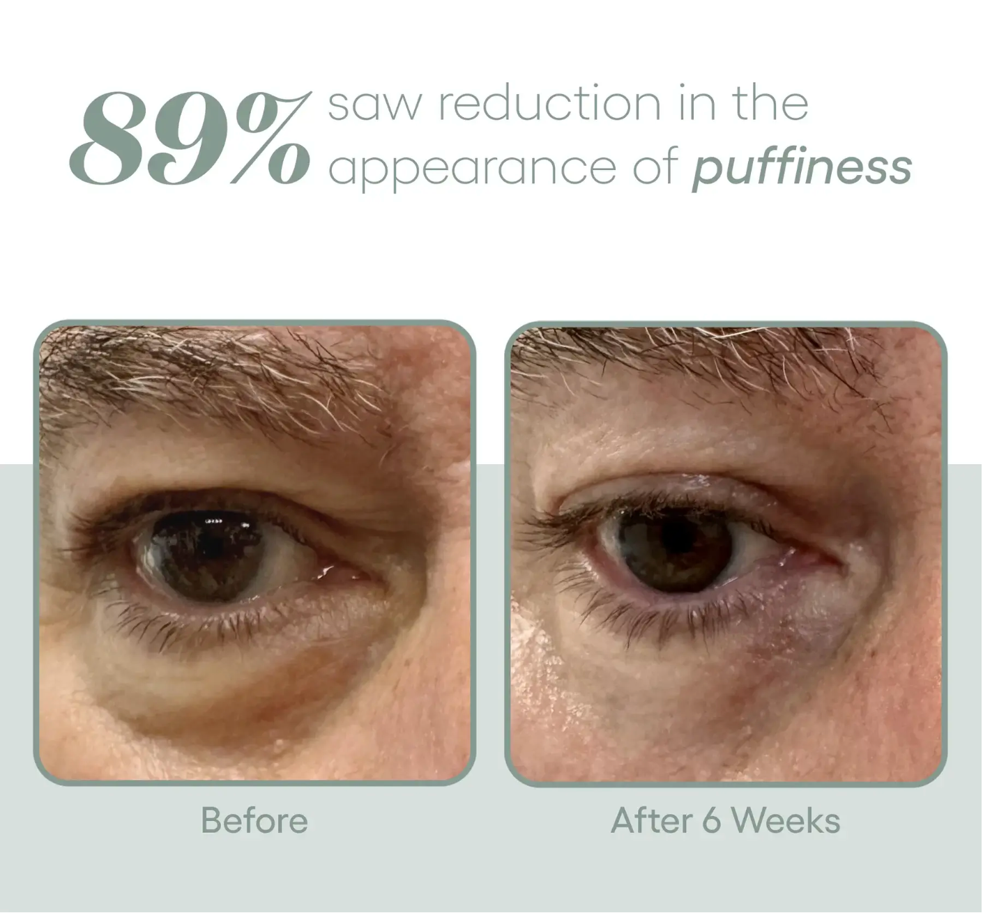 Plated Eye Exosome Serum